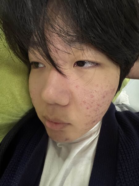 파일:Psm1.jpg